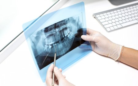 Why Dentists Recommend a CBCT Scan: Benefits of Modern Dental Radiology Services