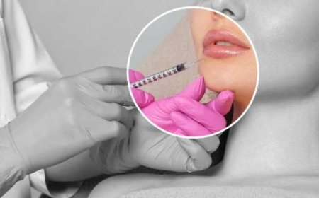 How Long Does a Masseter Injection With BOTOX Last?