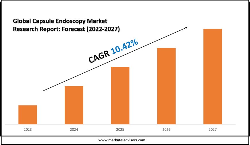 Capsule Endoscopy Market Value & Industry Overview | Growth Outlook 2027