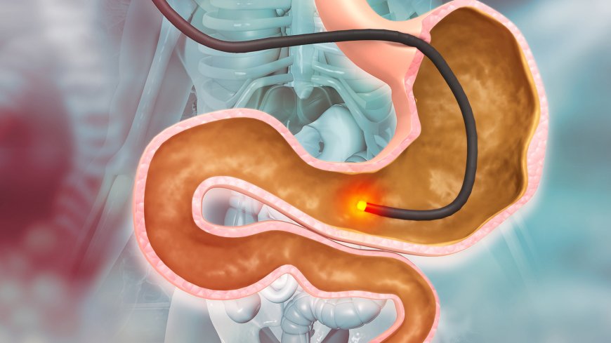 Endoscopic Examination Services: Early Detection for Better Health Outcomes