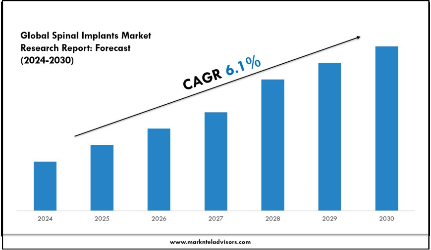 Spinal Implants Market Size, Trends and Forecast Analysis 2024–2030